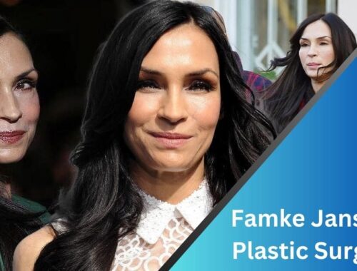 Famke Janssen Plastic Surgery